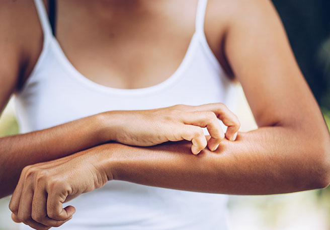 Frau kratzt sich am Unterarm